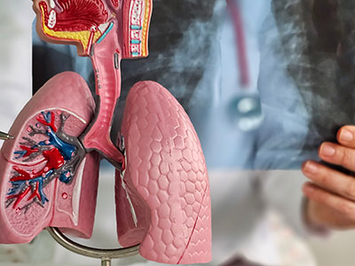 lung cancer detection